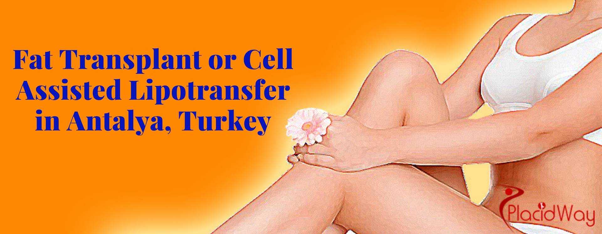 Fat Transplant or Cell Assisted Lipotransfer in Antalya, Turkey